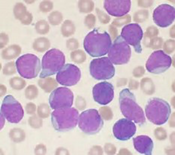 Cells in purple dye