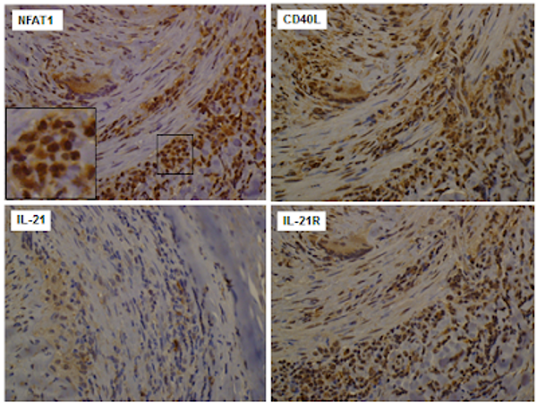 Immunohistochemistry staining to confirm "epigentic immunophenotyping" results in giant cell arteritis  (Source:  Coit et al. Annals of the Rheumatic Diseases 2015)