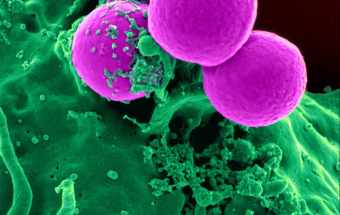 Pink sphere cells with green liquid background