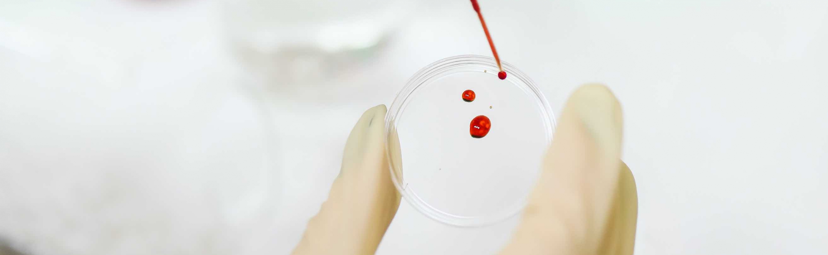 Blood in Petri dish